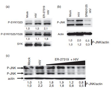 HIV-1 induces B-cell activation and class switch recombination via spleen tyrosine kinase and c-Jun N-terminal kinase pathways. imagen