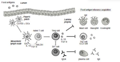 The role of regulatory T cells in the acquisition of tolerance to food allergens in children. imagen
