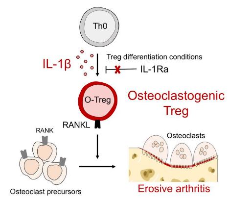 IL-1β-driven osteoclastogenic Tregs accelerate bone erosion in arthritis. imagen